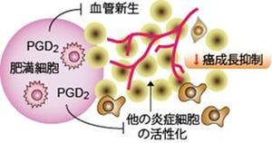 東大、肥満細胞が産出する生理活性物質ががんの成長を抑制することを確認