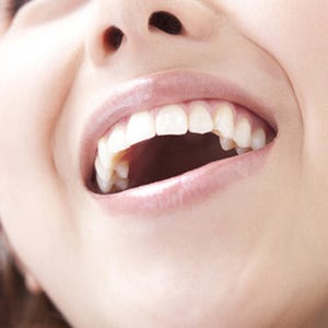 口臭や感染症罹患の原因にもなる口呼吸のデメリットを歯科医が解説