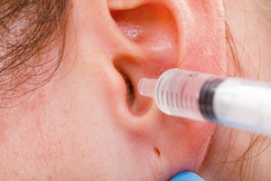 耳垢がたまりやすい人は耳垢栓塞の恐れアリ! 自分で治せるの?