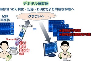 “体の音”を診るデジタル聴診器 オンキヨーが富山大と研究開発