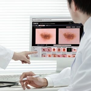 皮膚を撮影した画像から診断する方法を学べる - カシオの画像処理技術を応用した医師向けクラウドサービス