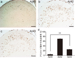 理研ら、「Aβ43」をアルツハイマーの強力な病態促進因子であることを発見