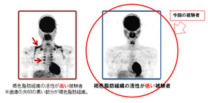 味の素と天使大、辛くないトウガラシ成分の摂取で代謝活性の向上を確認