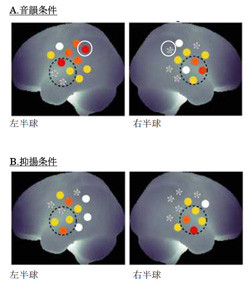 慶応大、新生児の脳でも日本語の抑揚の変化に反応することを確認