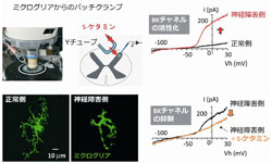 九大、S体ケタミンの神経障害性疼痛に対する鎮痛作用の標的分子を特定