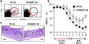 東大、炎症性腸疾患を悪化させる免疫細胞の新たな活性化メカニズムを発見