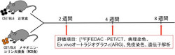 NIRS、脂肪肝を早期に診断できるPET薬剤を開発 