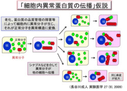 タンパク質「TDP-43」の構造異常の差がALSなどの病型を生む 