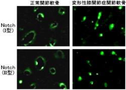 東大、変形性膝関節症をNotch阻害剤「DAPT」の注射で予防できることを確認