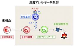 アレルギーの火付け役を火消し役に変換することで炎症を抑制 