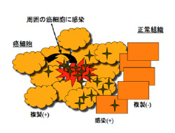 東大、再燃前立腺がんに対するヘルペスウイルス療法の臨床研究を開始