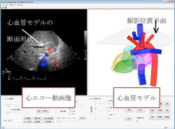 国循、5分程度で心血管構造を3DCGモデル化して表示できるシステムを開発