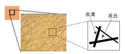 乾燥によるキメの大きな乱れは皮膚の角層細胞の縮みによる 