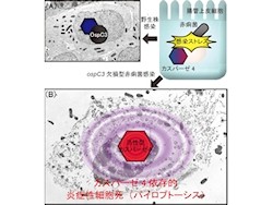 東大、赤痢菌などに感染された細胞が自殺する仕組みを解明