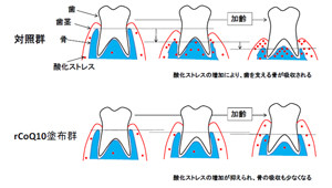 還元型コエンザイムQ10の塗布で歯茎の加齢変化を抑制できる -岡山大が確認