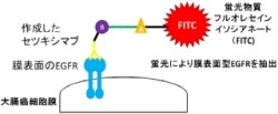 慶応大、大腸がん用分子標的治療薬「セツキシマブ」の効果をアップ