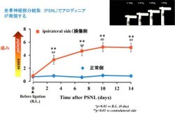 福岡大など、「神経障害性疼痛」の発現にケモカイン「CCL-1」の関与を証明