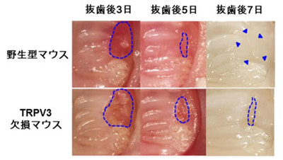 口の中の傷を速く治す上皮の謎を解明