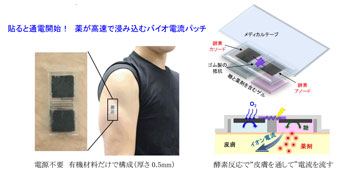 東北大、電池不要のバイオ発電パッチを開発 