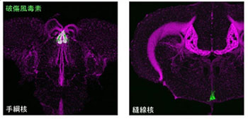 理研、パニック抑制する細胞を発見 