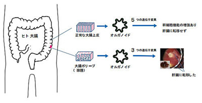 体外で大腸がん再現、腺腫のリスク実証