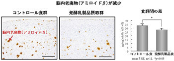 カマンベールチーズにアルツハイマー病を予防する効果 