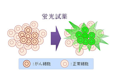 微小がん検出のスプレー蛍光試薬を開発