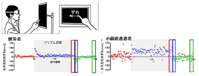 小脳の運動学習の定量的測定法を開発