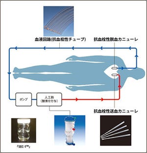 東洋紡、全身性炎症反応の抑制が可能な抗血栓性コーティング材料を開発