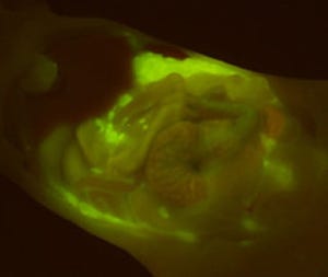 東大など、スプレーしてから1分前後でがん細胞が光り出す蛍光試薬を開発