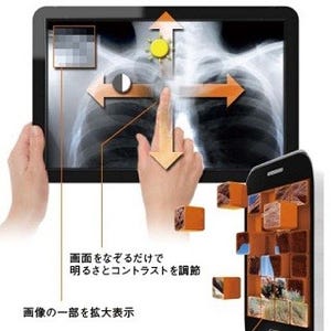 ラネクシー、米社製Android向け医用画像アプリケーション開発ツールを販売
