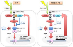 東大と群大、悪性「非ホジキンリンパ腫」の発症メカニズムの一端を解明