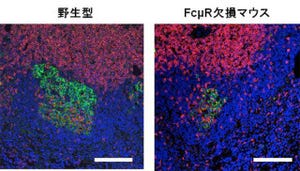 理研、初期の感染防御に必須であるIgM抗体の受容体「FcμR」の機能を解明