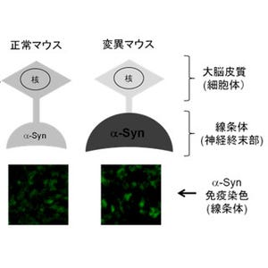 パーキンソン病などの原因の一端を解明 -阪大、神経末部にα-Syn集積を確認