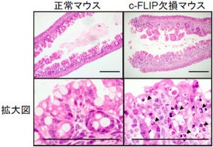 細胞死抑制遺伝子「c-FLIP」は腸管や肝臓の恒常性維持に必須 - 順天堂大