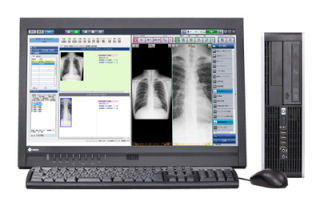 コニカミノルタ、電子カルテ機能を搭載の医療用画像オールインワンシステム