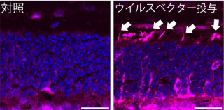 阪大、「網膜色素変性症」の遺伝子治療の有効性をマウスの実験で実証