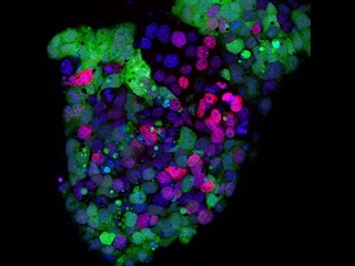 東北大など、多能性幹細胞を生殖細胞に変化させるスイッチの1つを発見