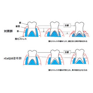 還元型コエンザイムQ10の塗布で歯茎の加齢変化を抑制できる -岡山大が確認
