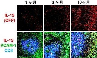 京大など、サイトカイン「IL-15」を産生する細胞を体内で可視化に成功