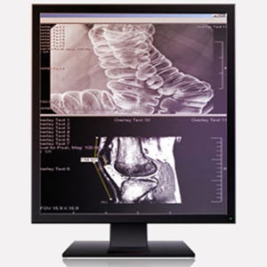 グレープシティ、3D表示に対応した画像医療診断システム用ソリューション