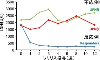 阪大、抗体医薬「ソリリス」に日本人が不応性を示すことが多い機序を解明