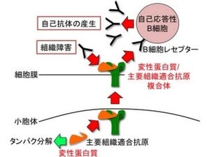 阪大など、自己免疫疾患の発症に関与する自己抗体の仕組みを究明