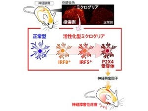 九大など、慢性疼痛の原因タンパク質が「IRF5」であることを究明