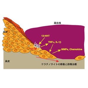 順天堂大、アスピリンの新しい副作用発現メカニズムなどを解明