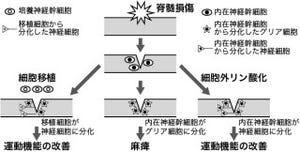 京大、脊髄損傷の神経細胞の産生を亢進させ下肢麻痺を改善させることに成功