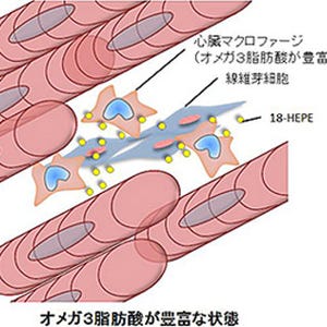 オメガ3脂肪酸の摂取で心機能が改善できる機構 - 理研などが解明