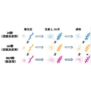 統合失調症のさまざまな症状は記憶シナプスの減少によって生じる - NCNP