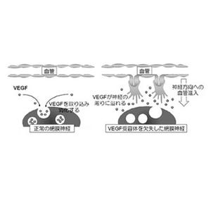 血管が網膜で排除される仕組みを解明