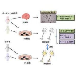 慶大など、パーキンソン病患者由来のiPS細胞を樹立 - 脳内の病態を解明